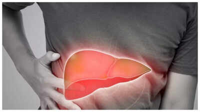 Fatty Liver Symptoms: 5 early symptoms of Non-alcoholic Fatty Liver Disease |