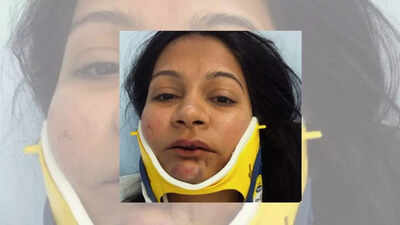 ‘I don’t feel like myself anymore’: Indian-origin couple’s story of being punched, kicked by Chinese man at Switzerland hotel goes viral